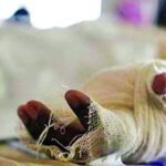 Burned-Patient-6883556ee84a9